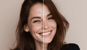 AI Photo Retouch
