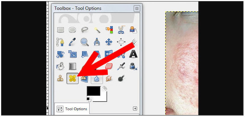 Activate Healing Tool