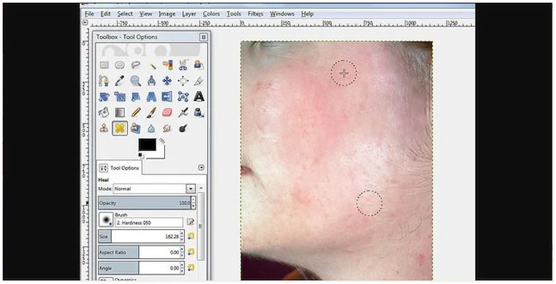 Repeatedly Click Blemishes